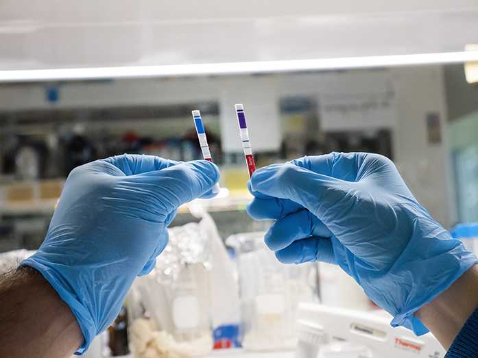 COVID-19: hacia el primer test de ant&iacute;genos 100 % argentino